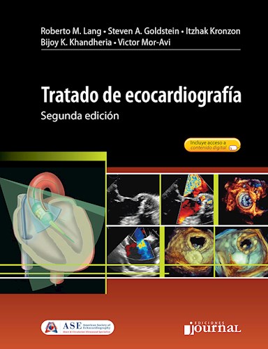 Tratado de ecocardiografía