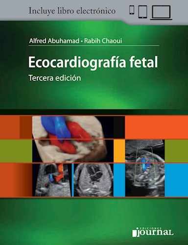 Ecocardiografía fetal