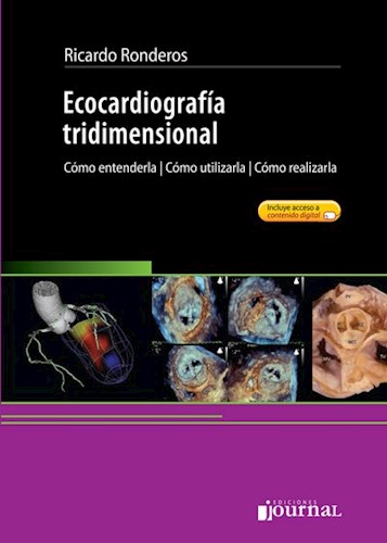 Ecocardiografía tridimensional Cómo entenderla, cómo utilizarla, cómo realizarla