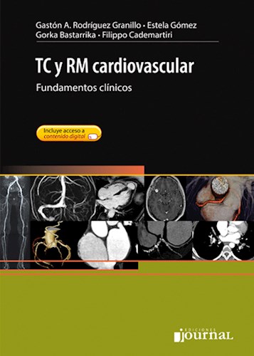 TC y RM cardiovascular Fundamentos Clínicos