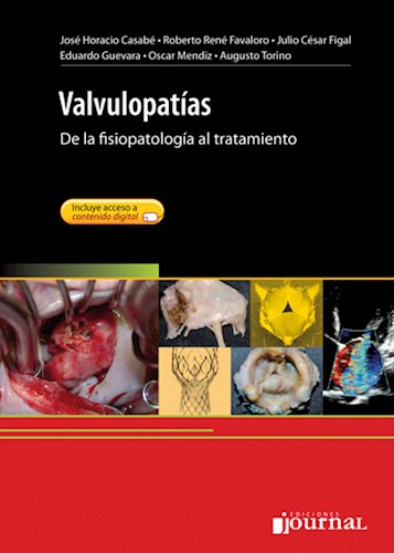 Valvulopatías De la fisiopatología al tratamiento