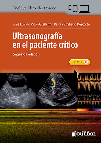 Ultrasonografía en el paciente crítico