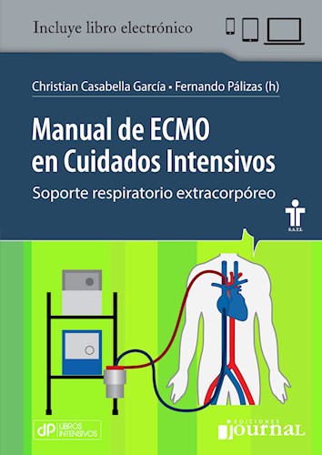 Manual de ECMO en Cuidados Intensivos Soporte respiratorio extracorpóreo