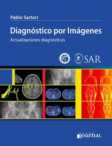 Diagnóstico por imágenes    eBook   Actualizaciones diagnósticas