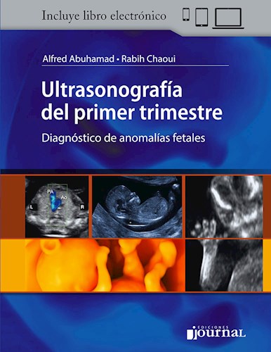 Ultrasonografía del primer trimestre Diagnóstico de anomalías fetales