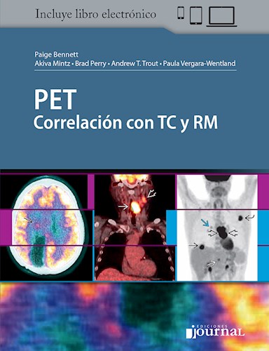 PET Correlación con TC y RM 