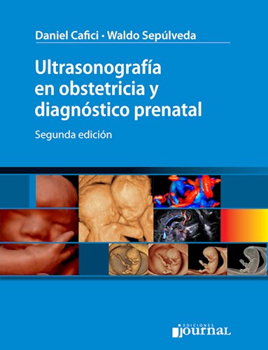 Ultrasonografía en obstetricia y diagnóstico prenatal 