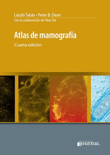 Atlas de mamografía 