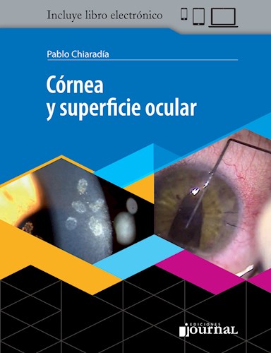 Córnea y superficie ocular