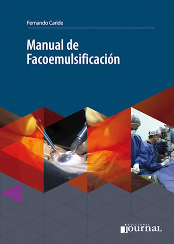 Manual de facoemulsificación 