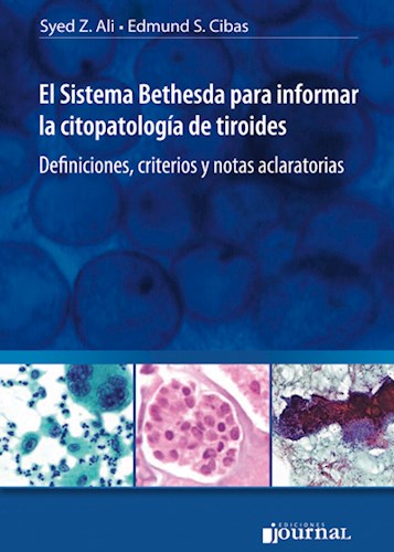 El Sistema Bethesda para informar la citopatología de tiroides Definiciones, criterios y notas aclaratorias