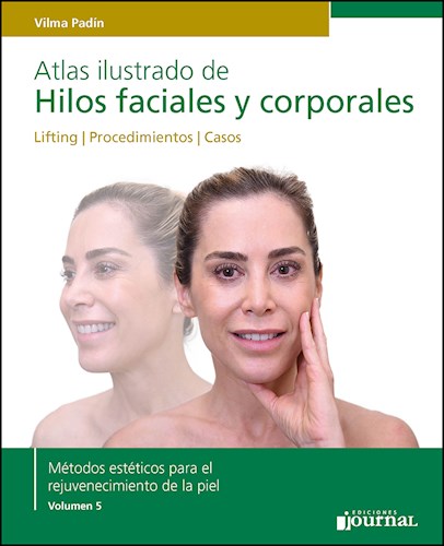 Atlas ilustrado de Hilos faciales y corporales Lifting    Procedimientos     Casos