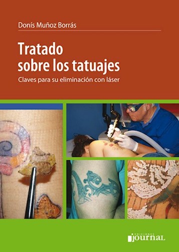 Tratado sobre tatuajes Claves para su eliminación con láser