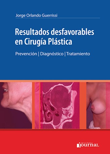 Resultados desfavorables en Cirugía Plástica Prevención     Diagnóstico   Tratamiento