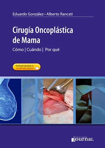 Cirugía Oncoplástica de Mama Cúando    Cómo   Por qué