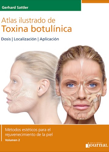 Atlas ilustrado de Toxina botulínica 