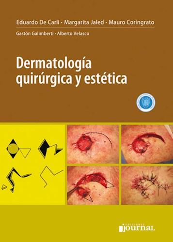 Dermatología quirúrgica y estética 1 Edición