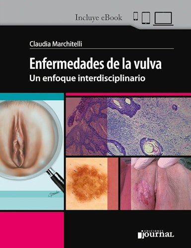 Enfermedades de la vulva Un enfoque interdisciplinario