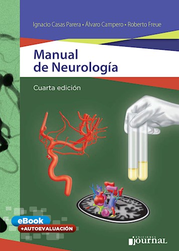 Manual de neurología 