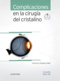 Complicaciones en la cirugía del cristalino