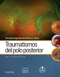 raumatismos del polo posterior