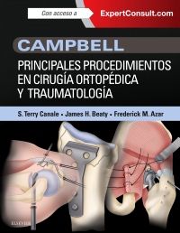 Campbell. Principales procedimientos en cirugía ortopédica y traumatología