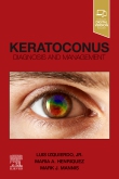 Keratoconus Diagnosis and Management