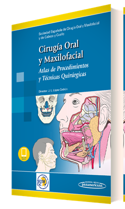 Cirugía Oral y Maxilofacial Atlas de procedimientos y técnicas quirúrgicas