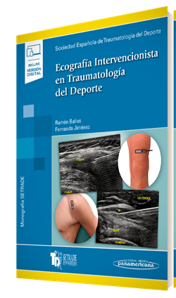 Traumatología del Deporte    Monografías SETRADE