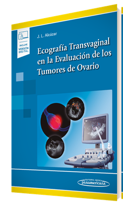 Ecografía Transvaginal en la Evaluación de los Tumores de Ovario