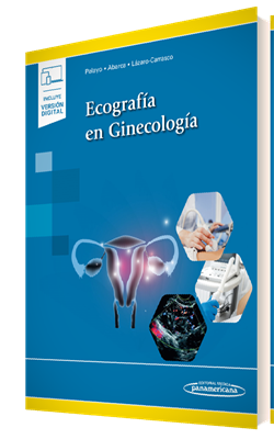 Ecografía en Ginecología