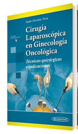 Cirugía Laparoscópica en Ginecología Oncológica Técnicas quirúrgicas e indicaciones