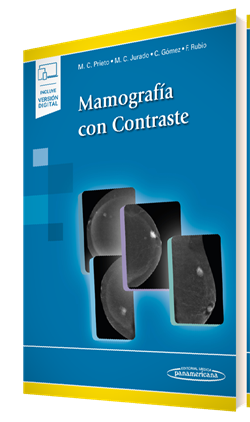 Mamografía con Contraste