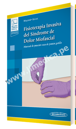 Fisioterapia Invasiva del Síndrome de Dolor Miofascial Manual de punción seca de puntos gatillo