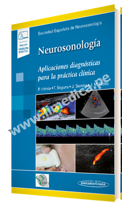 Neurosonología Aplicaciones diagnósticas para la práctica clínica