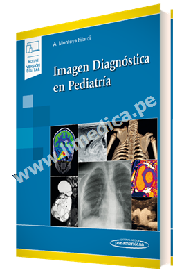 Imagen Diagnóstica en Pediatría