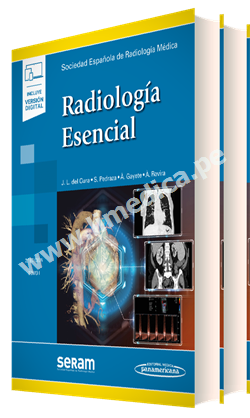 Radiología Esencial   2 Tomos