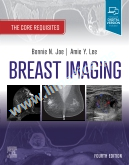 Breast Imaging   The Core Requisites