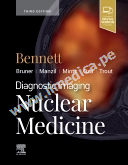 Diagnostic Imaging: Nuclear Medicine