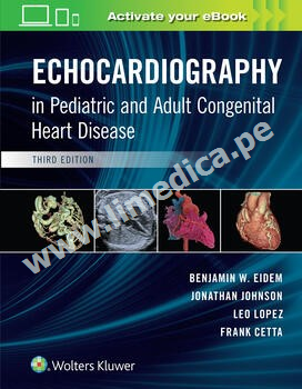 Echocardiography in Pediatric and Adult Congenital Heart Disease