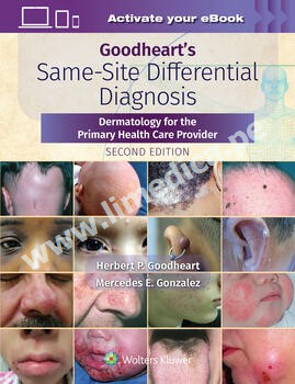 Goodheart   Same  Site Differential Diagnosis Dermatology for the Primary Health Care Provider