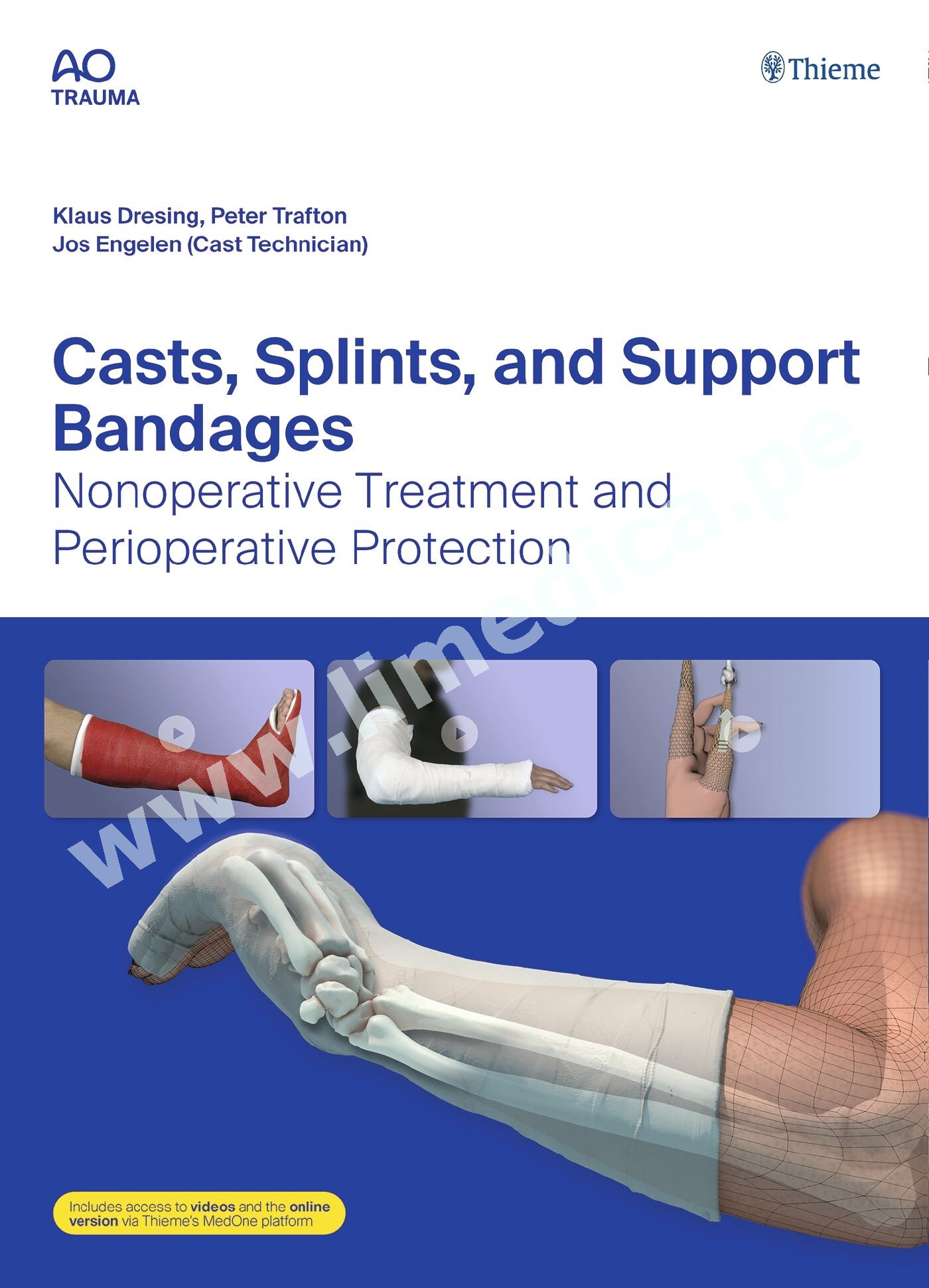 Casts, Splints, and Support Bandages Nonoperative Treatment and Perioperative Protection