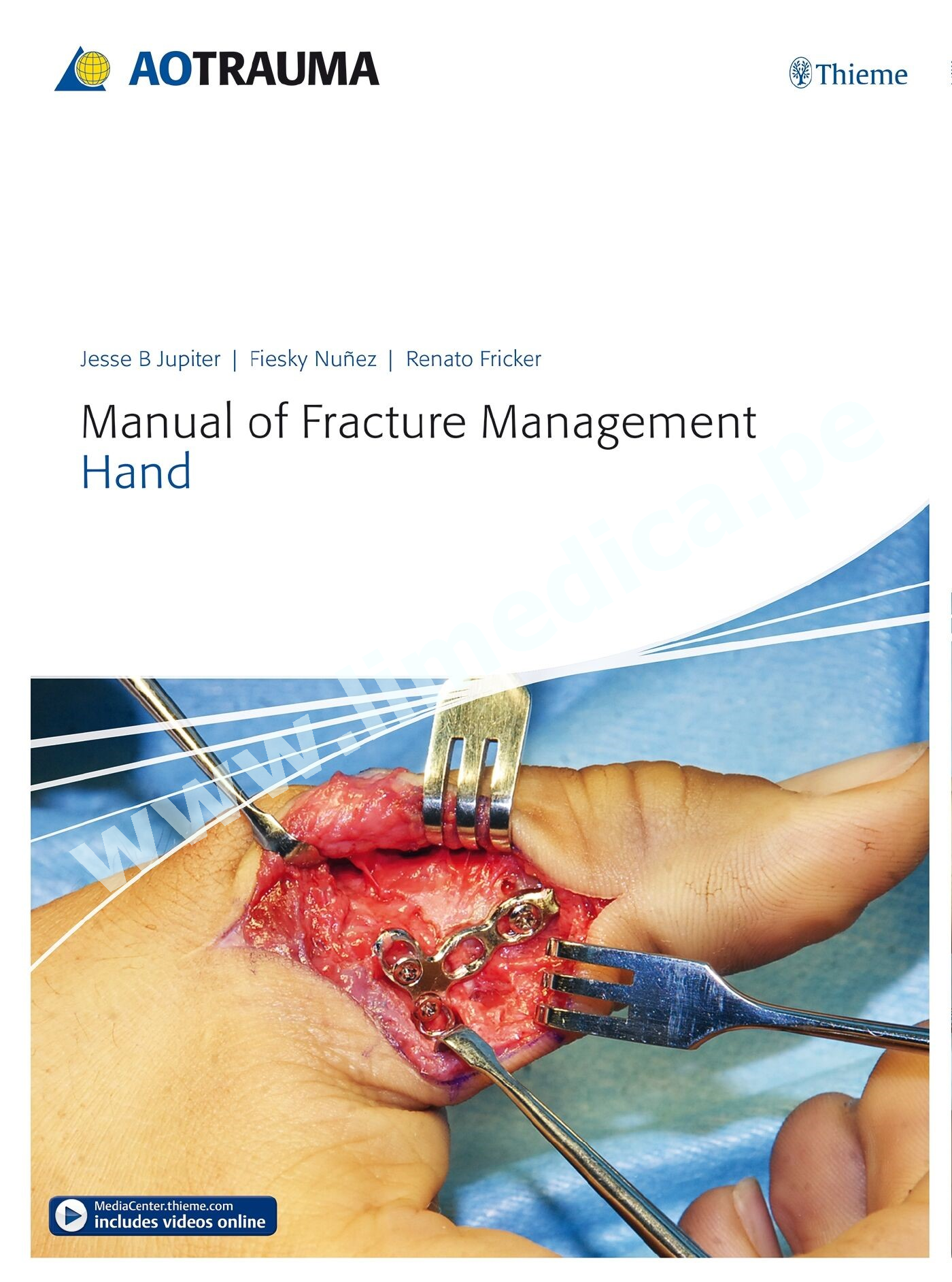 Manual of Fracture Management Hand