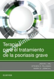 Terapias para el tratamiento de la psoriasis grave