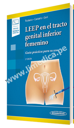 LEEP en el tracto genital inferior femenino Guía práctica para su uso