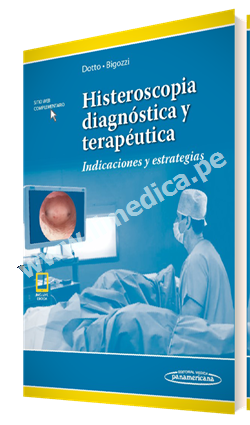 Histeroscopia diagnóstica y terapéutica Indicaciones y estrategias