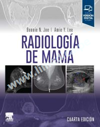 Radiología de mama