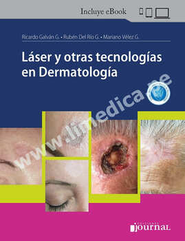 Laser  y  otras  Tecnologias   en  dermatologia
