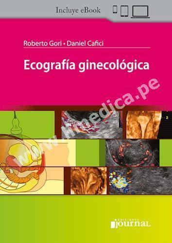 Ecografía ginecológica