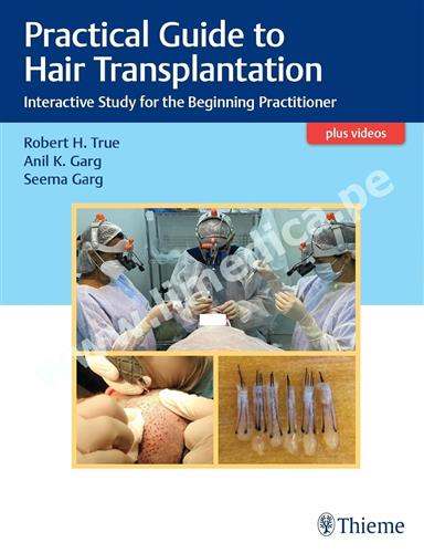 Practical Guide to Hair Transplantation Interactive Study for the Beginning Practitioner